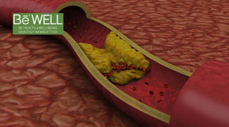 Ways You Can Maintain a Healthy Cholesterol, Improving Your Heart’s Health